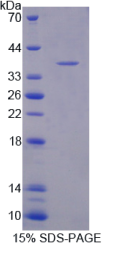 同种异体移植炎症因子1(AIF1)重组蛋白