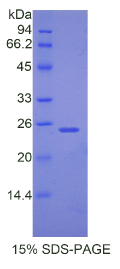 过氧化物酶体增殖物激活受体γ辅激活因子1α(PPARγC1α)重组蛋白