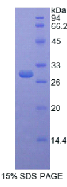 硒结合蛋白1(SELENBP1)重组蛋白