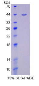 血型糖蛋白C(GYPC)重组蛋白