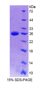 细胞因子信号转导抑制因子2(SOCS2)重组蛋白
