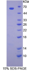 巨噬细胞炎性蛋白1β(MIP1β)重组蛋白