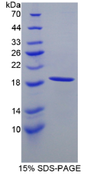 血红蛋白α1(HBα1)重组蛋白