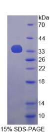 含衔接因子蛋白磷酸酪氨酸相互作用PH域亮氨酸拉链蛋白1(APPL1)重组蛋白