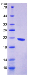 线粒体G延伸因子1(GFM1)重组蛋白