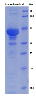 膜联蛋白A1(ANXA1)重组蛋白