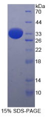 抑制蛋白β1(ARRβ1)重组蛋白