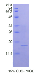 膜联蛋白A2(ANXA2)重组蛋白