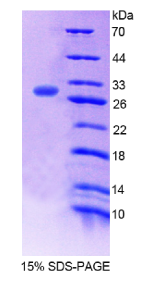 精子特异性抗原2(SSFA2)重组蛋白