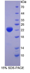 热休克蛋白β2(HSPβ2)重组蛋白