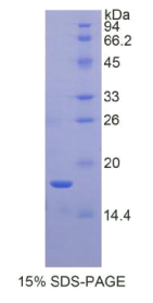 骨膜蛋白(POSTN)重组蛋白