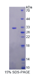 激肽释放酶2(KLK2)重组蛋白