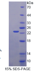 晶状体蛋白βB2(CRYβB2)重组蛋白