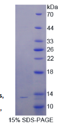 抗增生抗体靶分子1(TAPA1)重组蛋白