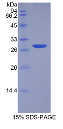 解整合素金属蛋白酶15(ADAM15)重组蛋白