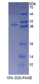 亲核素α3(KPNα3)重组蛋白