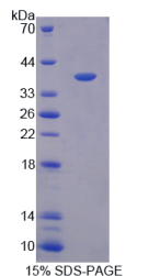 巨噬细胞炎性蛋白3β(MIP3β)重组蛋白