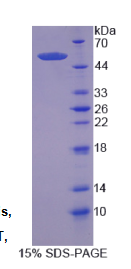红细胞衍生核因子2样蛋白2(NFE2L2)重组蛋白