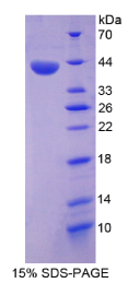 膜联蛋白A10(ANXA10)重组蛋白