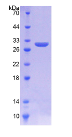 含环状结构跨膜蛋白1(KREMEN1)重组蛋白