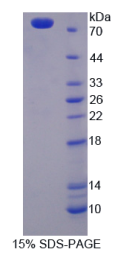 角蛋白28(KRT28)重组蛋白