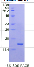高分子量激肽原(HMWK)重组蛋白