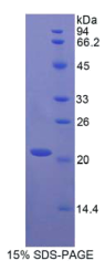 细胞毒性T-淋巴细胞关联抗原4(CTLA4)重组蛋白