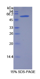 激肽释放酶6(KLK6)重组蛋白