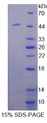 含卷曲螺旋域蛋白60(CCDC60)重组蛋白