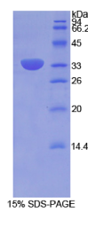 整合素β2(ITGβ2)重组蛋白