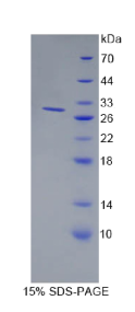 骨髓基质细胞抗原1(BST1)重组蛋白