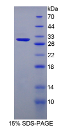硫酸软骨素蛋白多糖5(CSPG5)重组蛋白