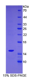 含SH2域蛋白1A(SH2D1A)重组蛋白