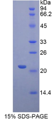 纤维蛋白原相关蛋白1(FGL1)重组蛋白
