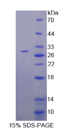 谷胱甘肽S转移酶α1(GSTα1)重组蛋白