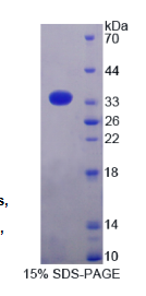 抗酶抑制因子1(AZIN1)重组蛋白