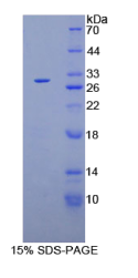 酪蛋白激酶1α1(CSNK1α1)重组蛋白