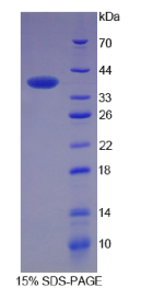 角蛋白4(KRT4)重组蛋白