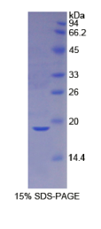 胱天蛋白酶2(CASP2)重组蛋白