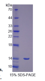 卵泡刺激素受体(FSHR)重组蛋白