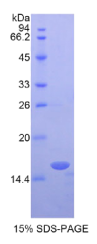 视黄醇结合蛋白3(RBP3)重组蛋白