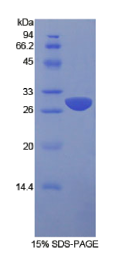 信号淋巴细胞激活分子家族成员1(SLAMF1)重组蛋白