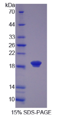 毛状样蛋白1(COTL1)重组蛋白