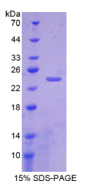 晶状体蛋白γS(CRYγS)重组蛋白