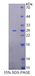 微小染色体维持缺陷蛋白5(MCM5)重组蛋白