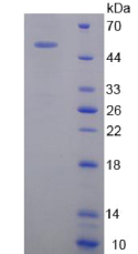 精氨酸/丝氨酸丰富剪接因子2(SRSF2)重组蛋白