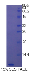 胸腺素β4(Tβ4)重组蛋白