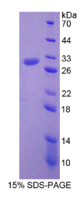 细胞程序性死亡蛋白6相互作用蛋白(PDCD6IP)重组蛋白