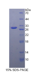 谷胱甘肽S转移酶κ1(GSTκ1)重组蛋白