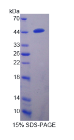 跨膜丝氨酸蛋白酶4(TMPRSS4)重组蛋白